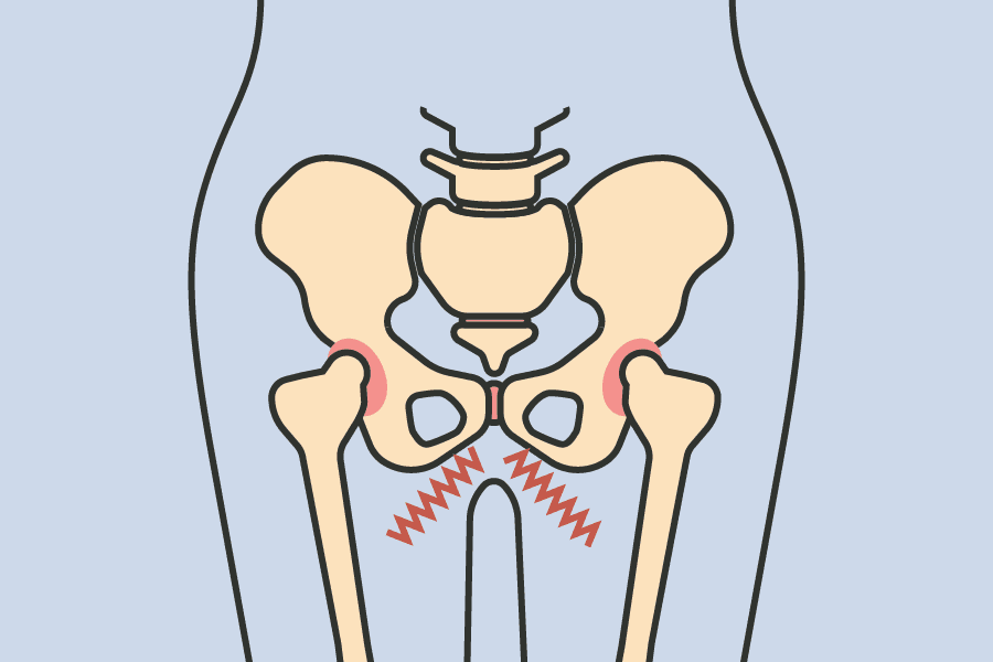 pelvic pain