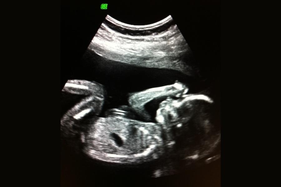 Fetal diagnostic 900x600